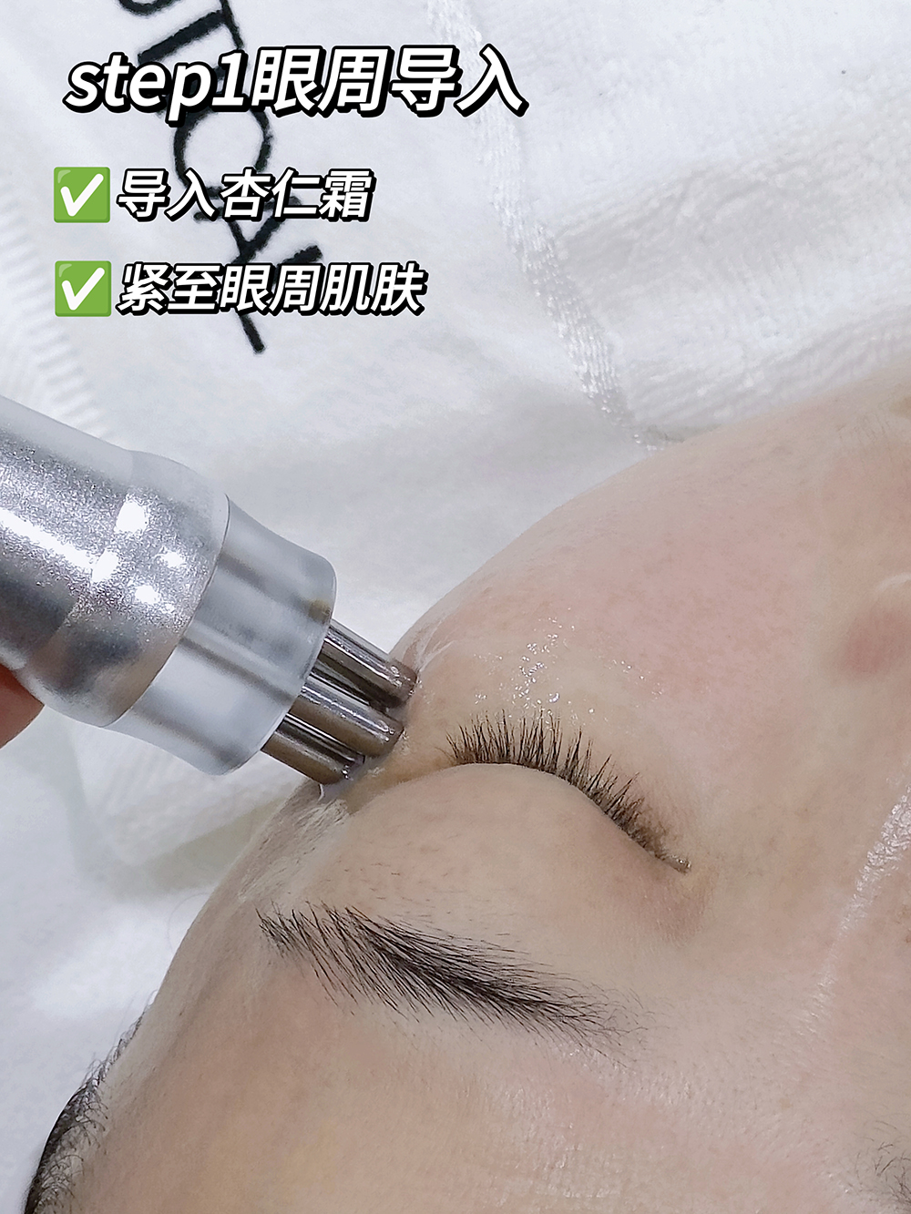 妍熙蔻熙眸眼袋紧致效果 妍熙蔻熙眸眼袋紧致效果
