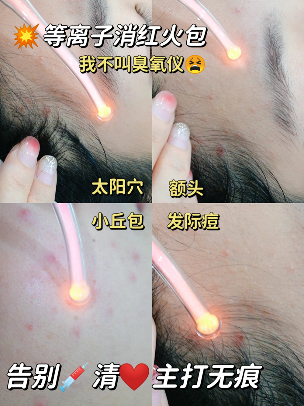 妍熙蔻极光净肤 妍熙蔻极光净肤